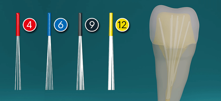 Biolight Drill-Free Fiber Posts